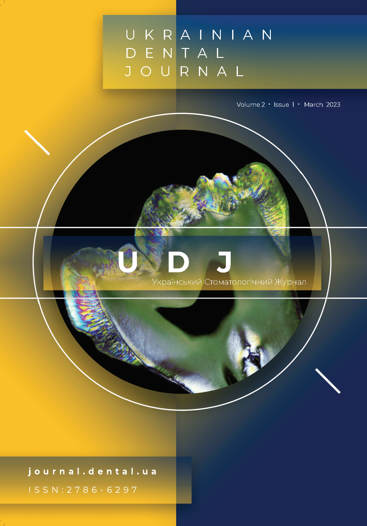 					View Vol. 2 No. 1 (2023): Ukrainian Dental Journal
				